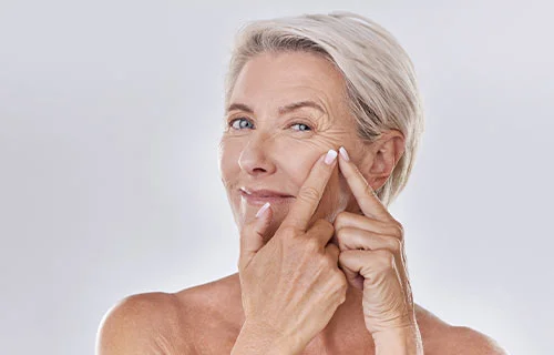 Crows Feet Treatment